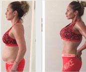 Antes y después de perder peso con Nano Slim